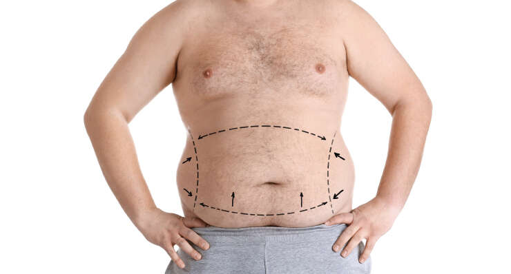 Bariatrics & Metabolic Surgery